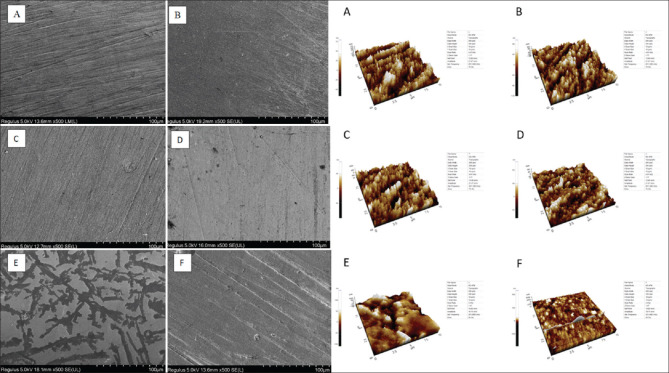 Effect of different polishing systems and speeds on the surface roughness of resin composites.