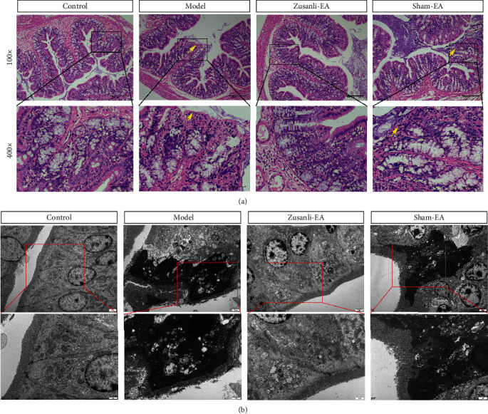 Electroacupuncture Zusanli (ST36) Relieves Somatic Pain in Colitis Rats by Inhibiting Dorsal Root Ganglion Sympathetic-Sensory Coupling and Neurogenic Inflammation.