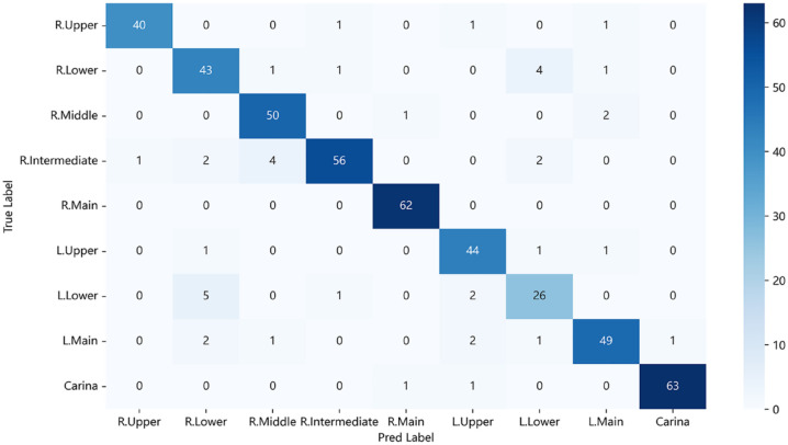 Distinguishing bronchoscopically observed anatomical positions of airway under by convolutional neural network.