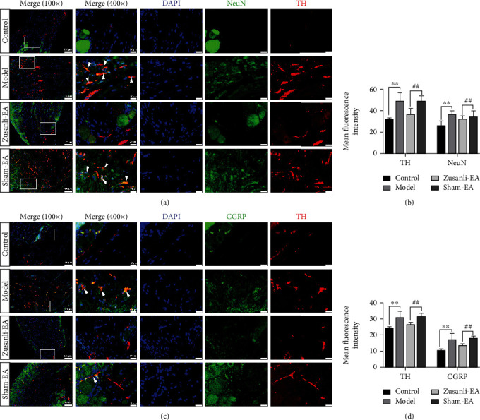 Electroacupuncture Zusanli (ST36) Relieves Somatic Pain in Colitis Rats by Inhibiting Dorsal Root Ganglion Sympathetic-Sensory Coupling and Neurogenic Inflammation.