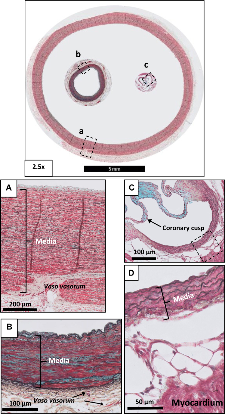 Validating human and mouse tissues commonly used in atherosclerosis research with coronary and aortic reference tissue: similarities but profound differences in disease initiation and plaque stability