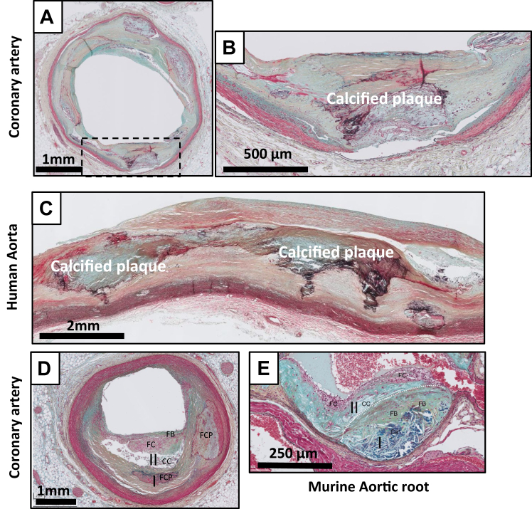 Validating human and mouse tissues commonly used in atherosclerosis research with coronary and aortic reference tissue: similarities but profound differences in disease initiation and plaque stability