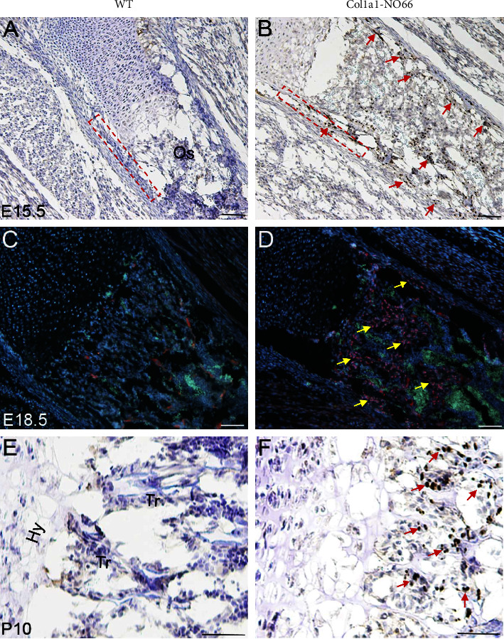 Osteoblast-Specific Overexpression of Nucleolar Protein <i>NO66</i>/RIOX1 in Mouse Embryos Leads to Osteoporosis in Adult Mice.