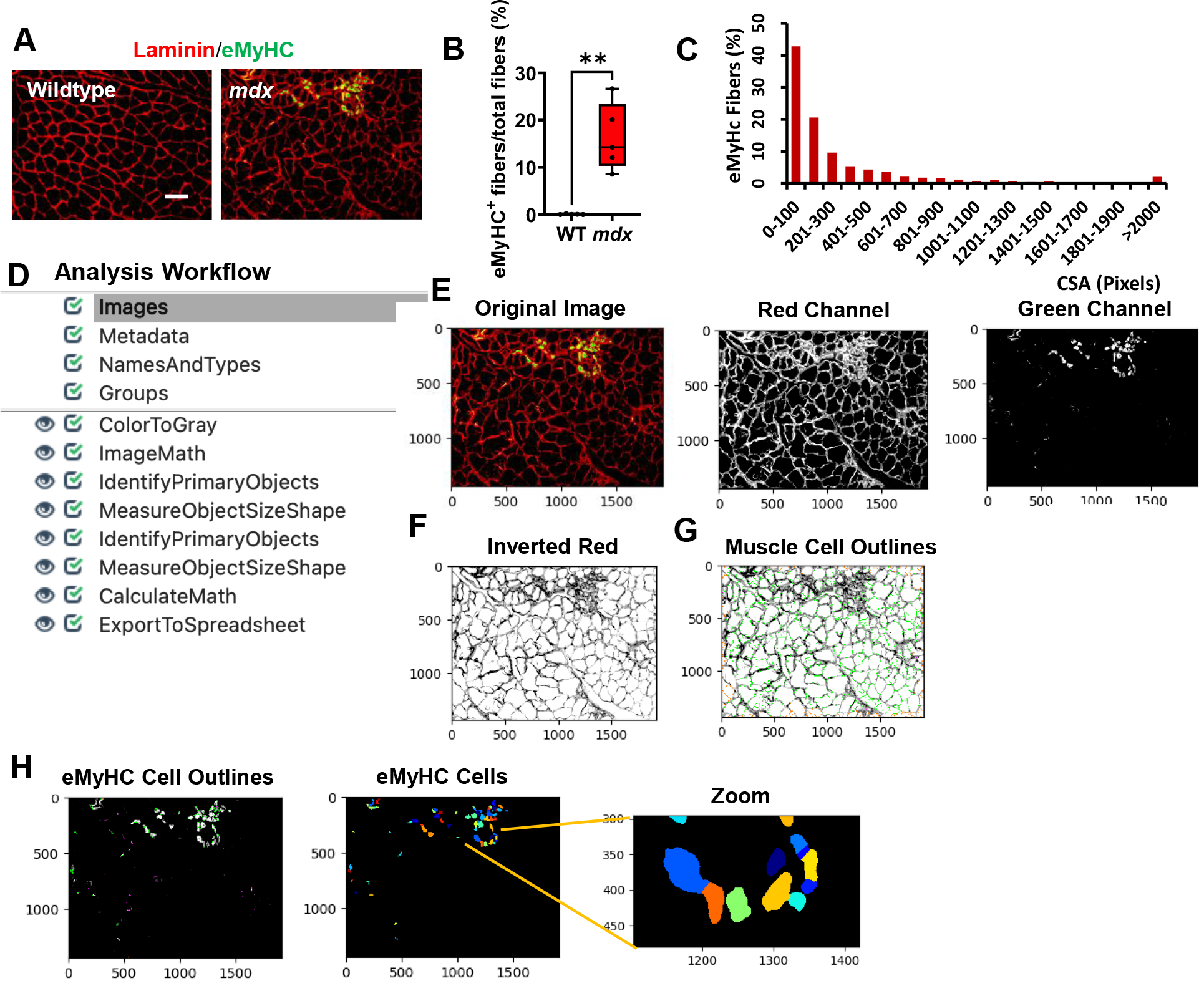 Automated Image Analysis Pipeline Development to Monitor Disease Progression in Muscular Dystrophy Using Cell Profiler.