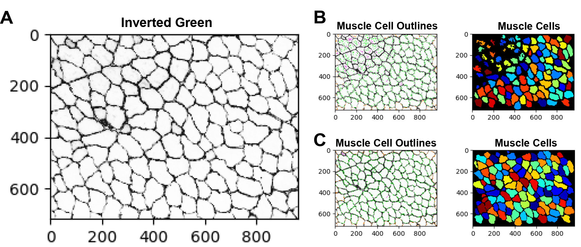 Automated Image Analysis Pipeline Development to Monitor Disease Progression in Muscular Dystrophy Using Cell Profiler.