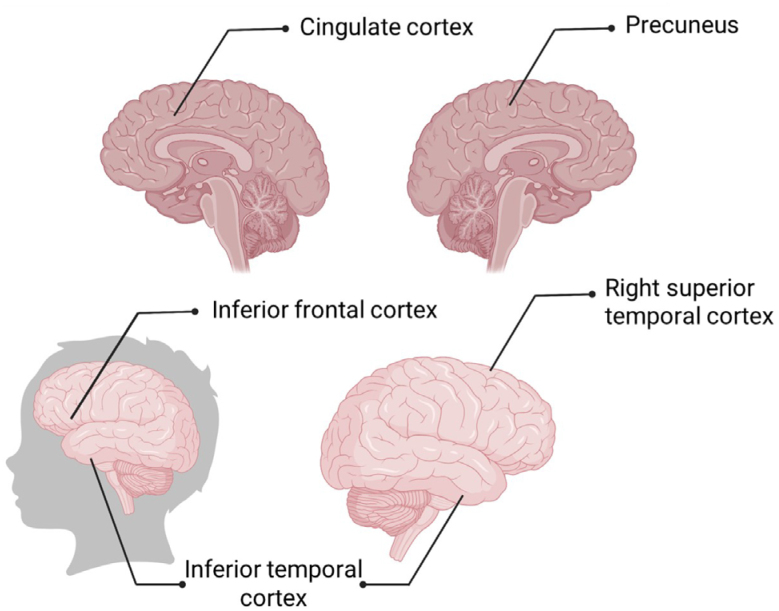 The impact of child poverty on brain development: does money matter?