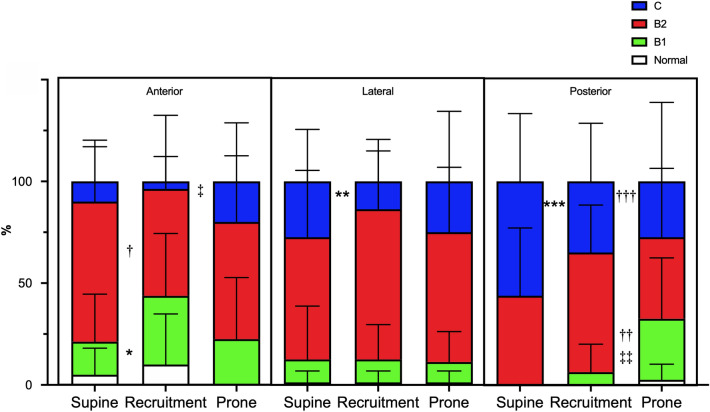 Lung ultrasound to evaluate aeration changes in response to recruitment maneuver and prone positioning in intubated patients with COVID-19 pneumonia: preliminary study.