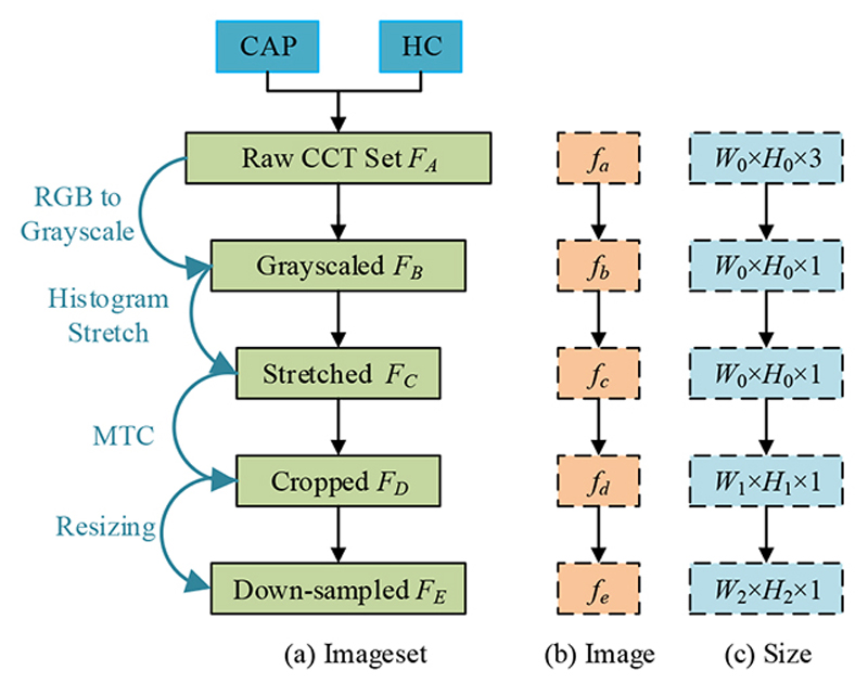 WACPN: A Neural Network for Pneumonia Diagnosis.