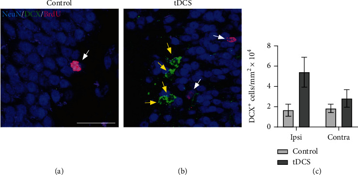 From Molecule to Patient Rehabilitation: The Impact of Transcranial Direct Current Stimulation and Magnetic Stimulation on Stroke-A Narrative Review.