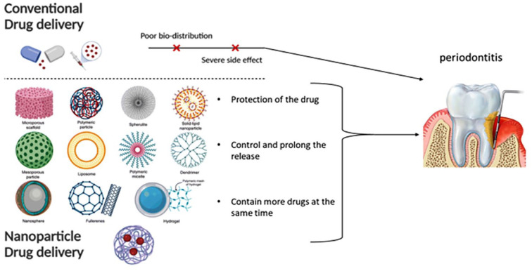 Impact of local drug delivery and natural agents as new target strategies against periodontitis: new challenges for personalized therapeutic approach.