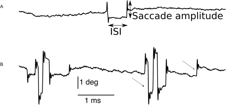 Monitoring Eye Movement in Patients with Parkinson's Disease: What Can It Tell Us?