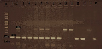 The Relation between ACE Gene Polymorphism and the Severity of COVID-19 Infection.