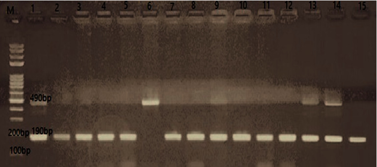 The Relation between ACE Gene Polymorphism and the Severity of COVID-19 Infection.