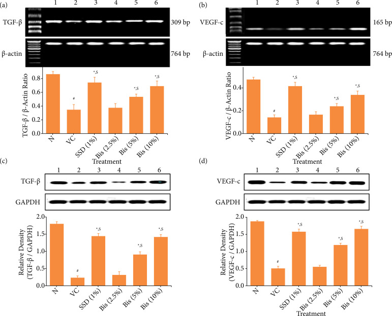 Bisacurone gel ameliorated burn wounds in experimental rats via its anti-inflammatory, antioxidant, and angiogenic properties.