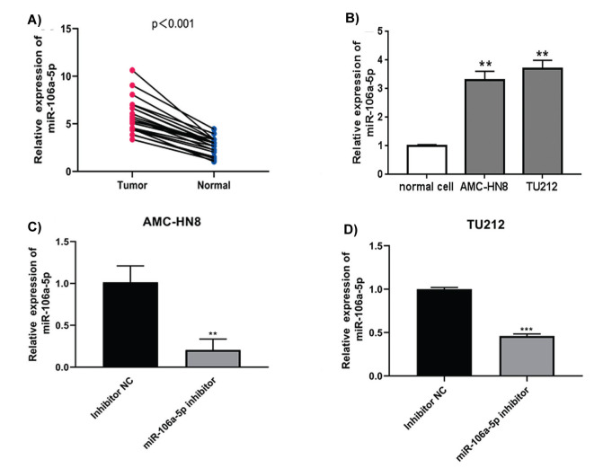 <i>MiRNA-106a-5p</i> Promotes Laryngeal Carcinoma Proliferation and Migration Through <i>PI3K/AKT/m-TOR</i> Pathway by <i>AKTIP</i>.