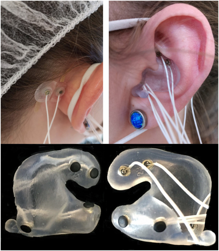 Assessment of Vestigial Auriculomotor Activity to Acoustic Stimuli Using Electrodes In and Around the Ear.