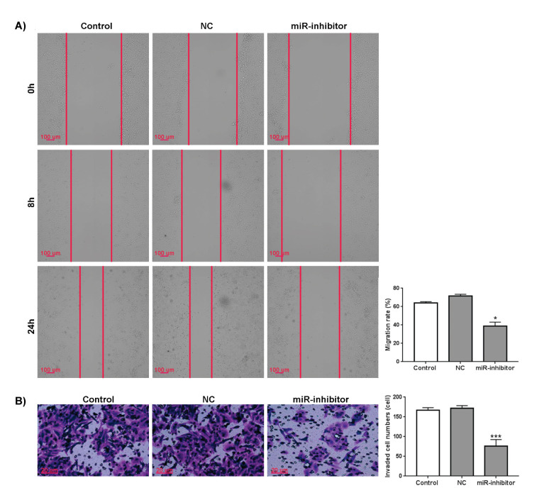 <i>MiRNA-106a-5p</i> Promotes Laryngeal Carcinoma Proliferation and Migration Through <i>PI3K/AKT/m-TOR</i> Pathway by <i>AKTIP</i>.