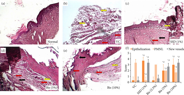 Bisacurone gel ameliorated burn wounds in experimental rats via its anti-inflammatory, antioxidant, and angiogenic properties.