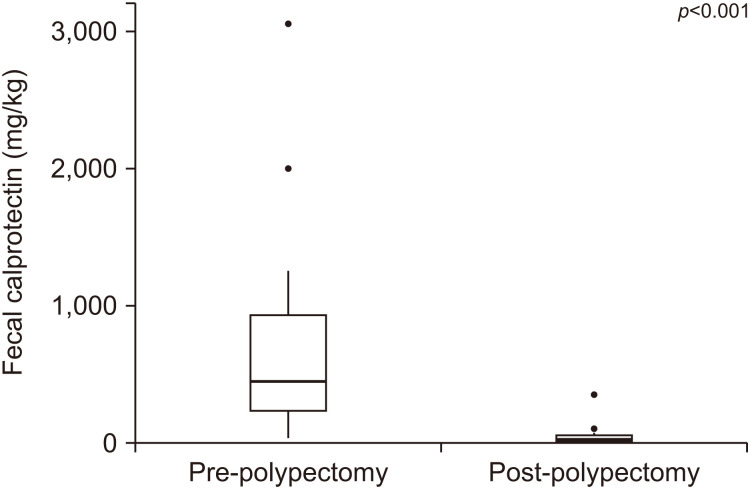 Fecal Calprotectin Levels Significantly Correlate with Polyp Size in Children and Adolescents with Juvenile Colorectal Polyps.