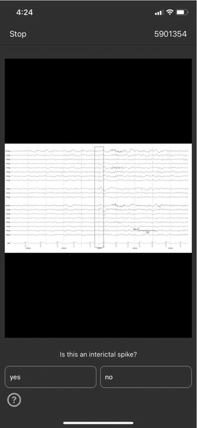 On-demand EEG education through competition – A novel, app-based approach to learning to identify interictal epileptiform discharges