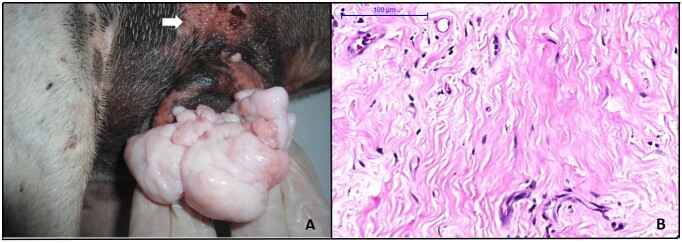 Fibrosis in canine transmissible venereal tumor after chemotherapy with vincristine.