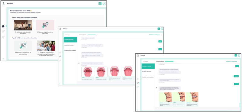 Perioperative Risk Assessment of Patients Using the MyRISK Digital Score Completed Before the Preanesthetic Consultation: Prospective Observational Study.