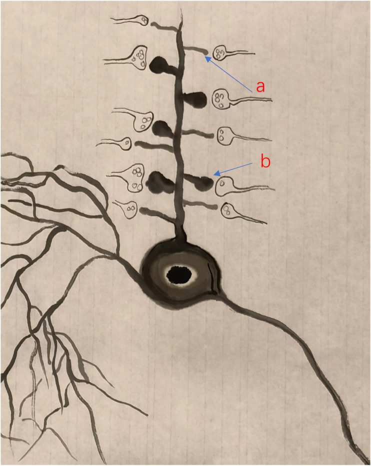 Silent synapses in pain-related anterior cingulate cortex.