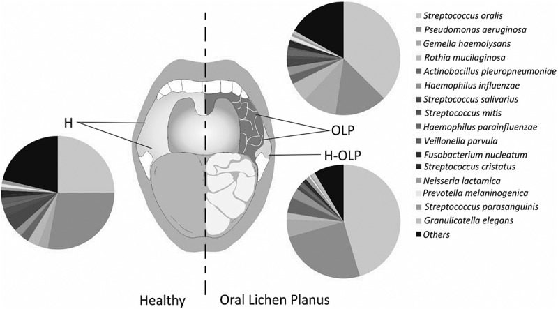 Metataxonomic and metaproteomic profiling of the oral microbiome in oral lichen planus - a pilot study.