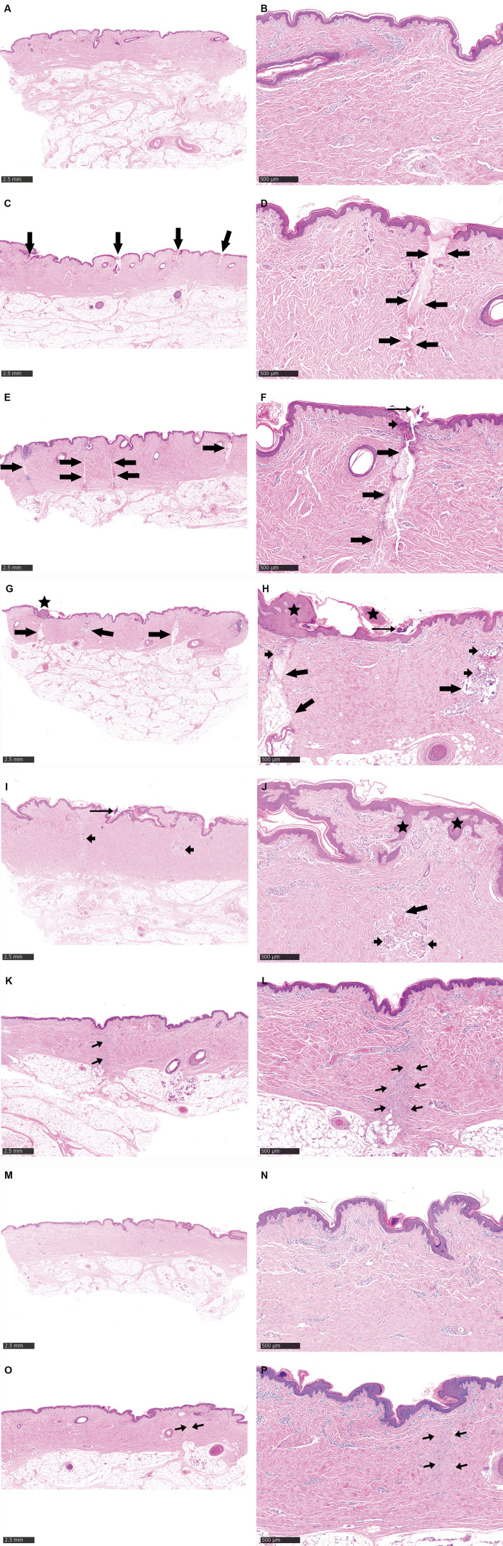 Safety and efficacy of a novel robotic, fractional micro-coring device in a swine model.