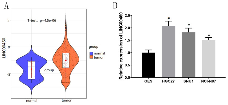 LINC00460 mediates HMGA2 expression through binding to miRNA-143-5p competitively in gastric carcinoma.