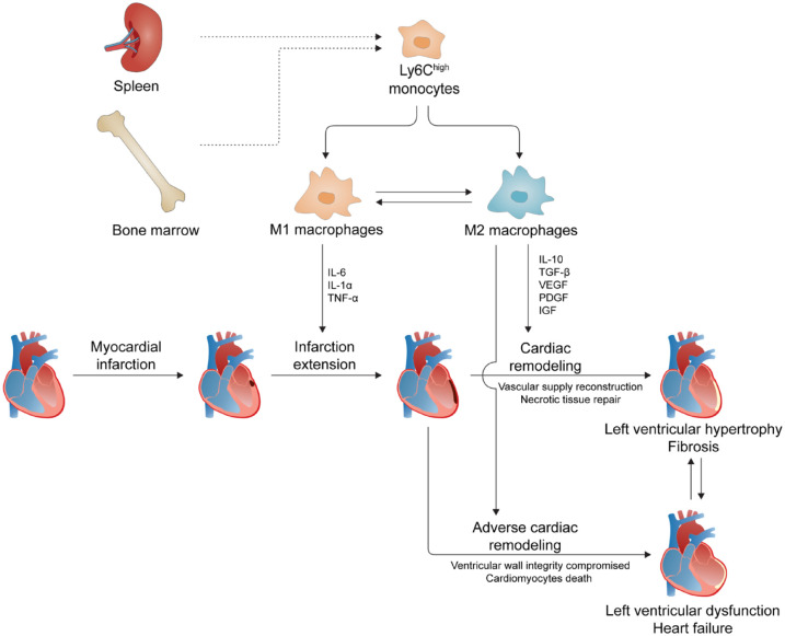 Emerging roles of macrophages in heart failure and associated treatment approaches.