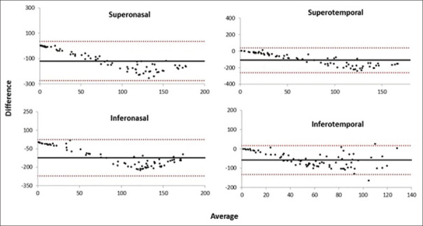 Comparison of Visual Field Measurements in Glaucomatous Eyes using Oculus and Metrovision Perimeters.