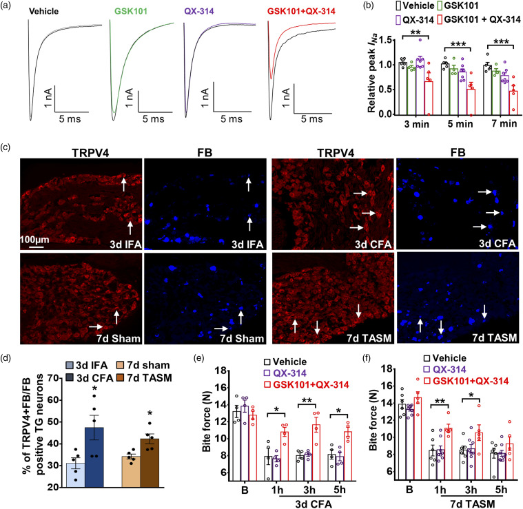 Silencing of TRPV4-expressing sensory neurons attenuates temporomandibular disorders pain.