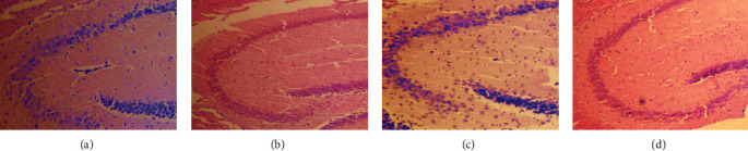 Naringin Protects against Tau Hyperphosphorylation in A<i>β</i> <sub>25-35</sub>-Injured PC12 Cells through Modulation of ER, PI3K/AKT, and GSK-3<i>β</i> Signaling Pathways.