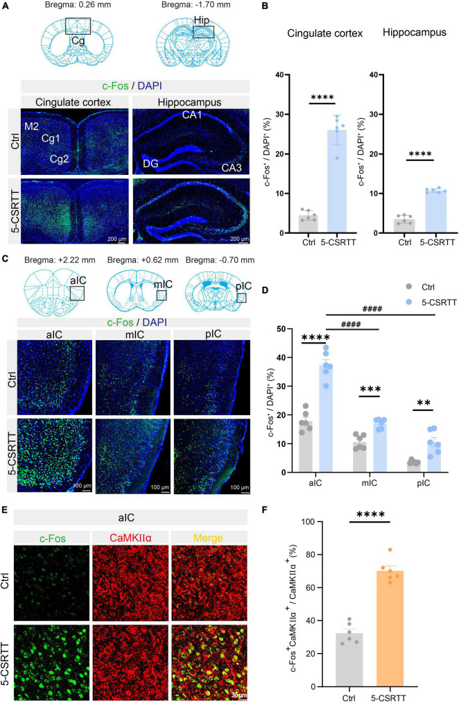 CaMKIIα neurons in the anterior insular cortex regulate attention behavior in mice.