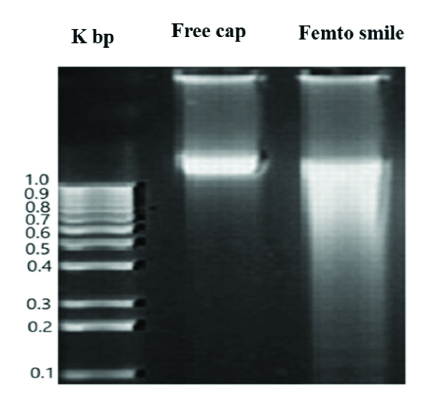 Histopathology of Corneal Lenticules Obtained from Small Incision Lenticule Extraction (SMILE) versus Microkeratome Excision.