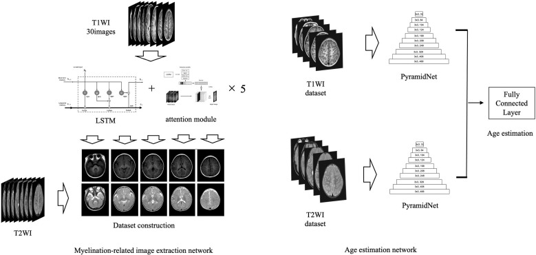 Automation of a Rule-based Workflow to Estimate Age from Brain MR Imaging of Infants and Children Up to 2 Years Old Using Stacked Deep Learning.