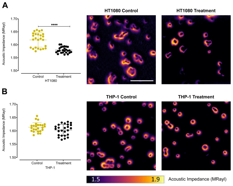 Application of scanning acoustic microscopy for evaluation of MMP activation in multiple cancer cell lines with a smart probe.