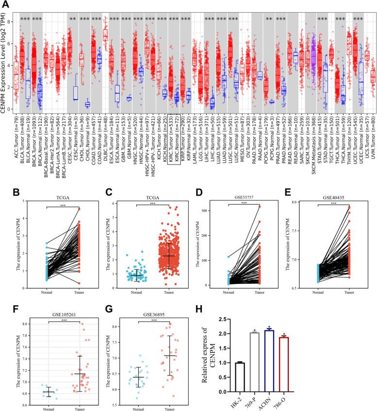 Upregulation of CENPM is associated with poor clinical outcome and suppression of immune profile in clear cell renal cell carcinoma.