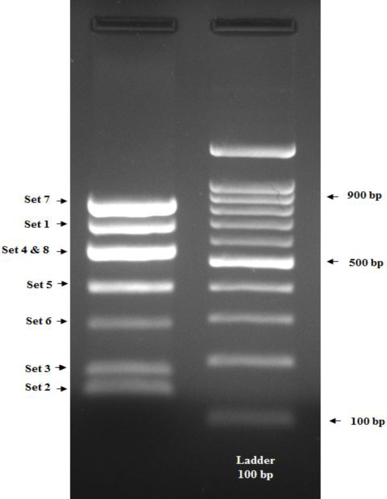 Multiplex Snapshot minisequencing for the detection of common PAH gene mutations in Iranian patients with Phenylketonuria