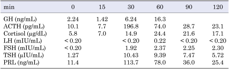 A novel missense variant of <i>FGFR1</i> in a Japanese girl with Kallmann syndrome and holoprosencephaly.