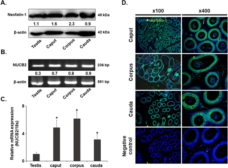 NUCB2/nesfatin-1 suppresses the acrosome reaction in sperm within the mouse epididymis.