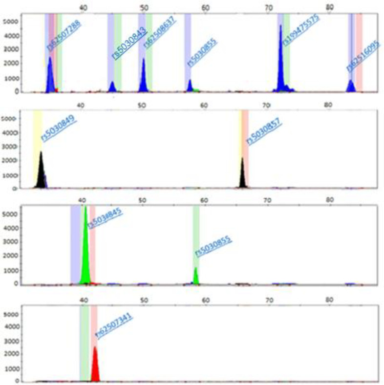 Multiplex Snapshot minisequencing for the detection of common PAH gene mutations in Iranian patients with Phenylketonuria