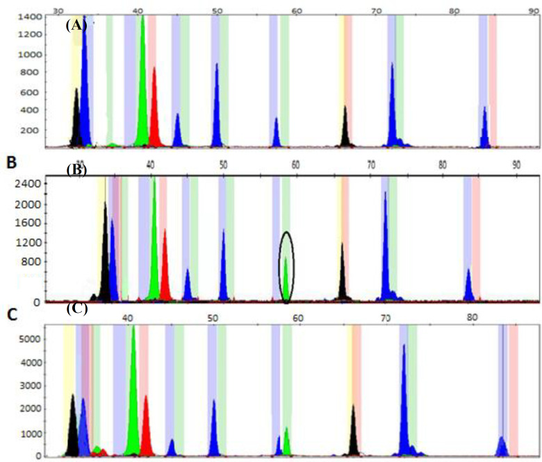 Multiplex Snapshot minisequencing for the detection of common PAH gene mutations in Iranian patients with Phenylketonuria