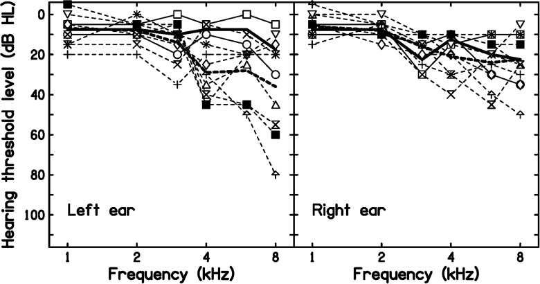 Diagnosing Noise-Induced Hearing Loss Sustained During Military Service Using Deep Neural Networks.