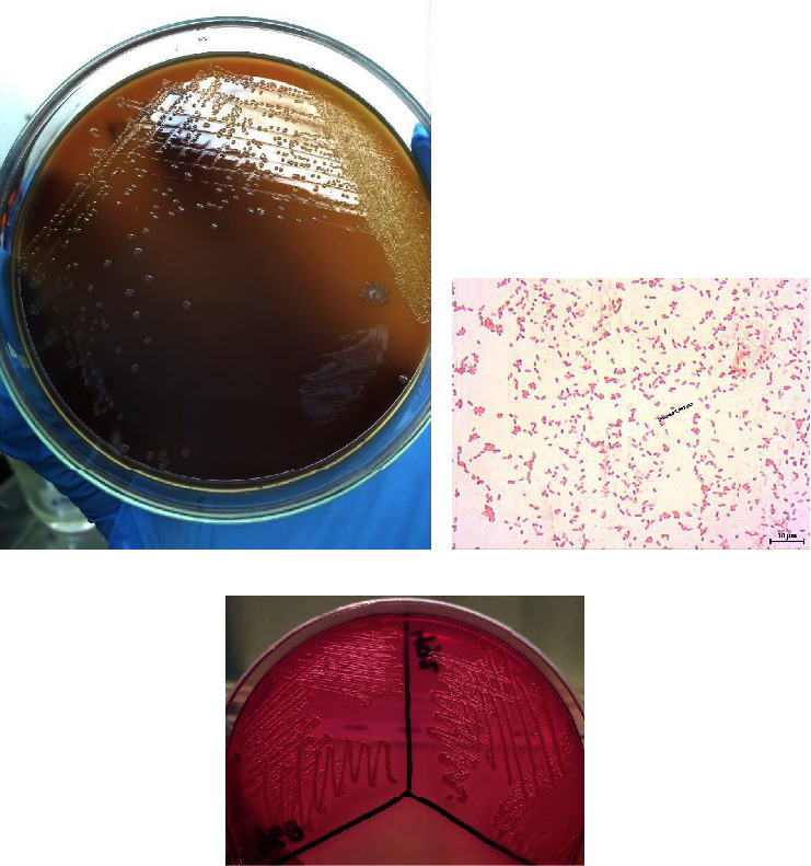 Morphology, Biochemical, and Molecular Characterization of <i>Pasteurella multocida</i> Causing Hemorrhagic Septicemia in Indonesia.