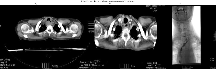 Changes in Oncological Surgical Principles Driven by Advances in Preoperative Treatments.