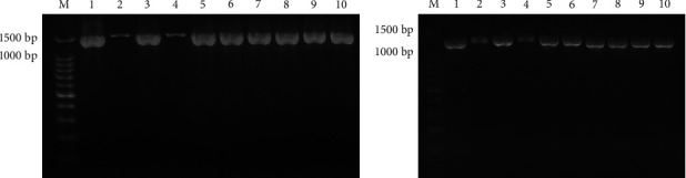 Morphology, Biochemical, and Molecular Characterization of <i>Pasteurella multocida</i> Causing Hemorrhagic Septicemia in Indonesia.