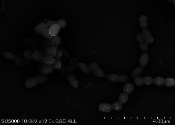 Description of <i>Streptococcus thalassemiae</i> sp. nov., a Bacterium Isolated from Human Blood.