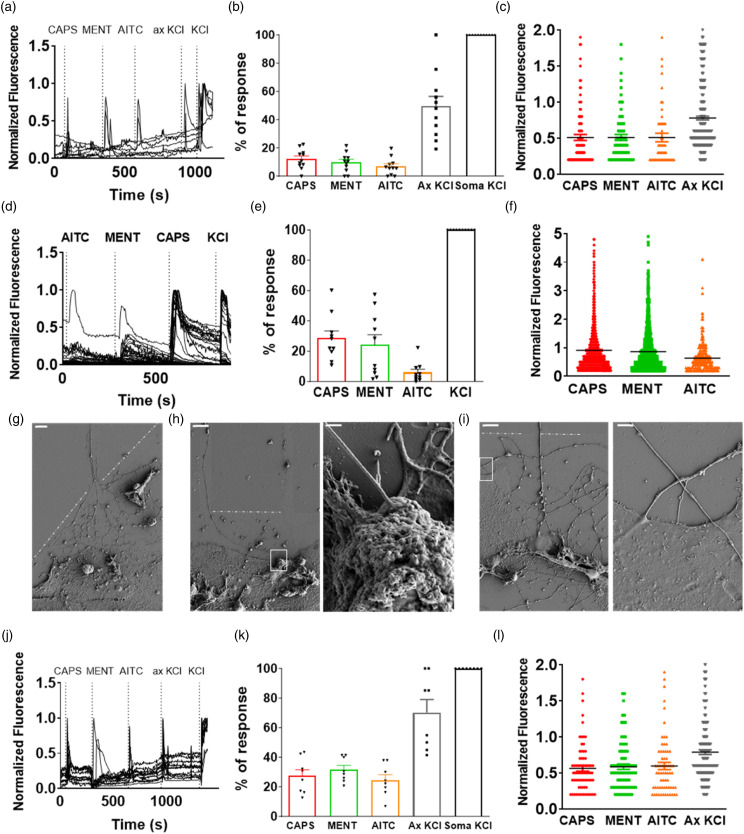 Compartmentalized primary cultures of dorsal root ganglion neurons to model peripheral pathophysiological conditions.